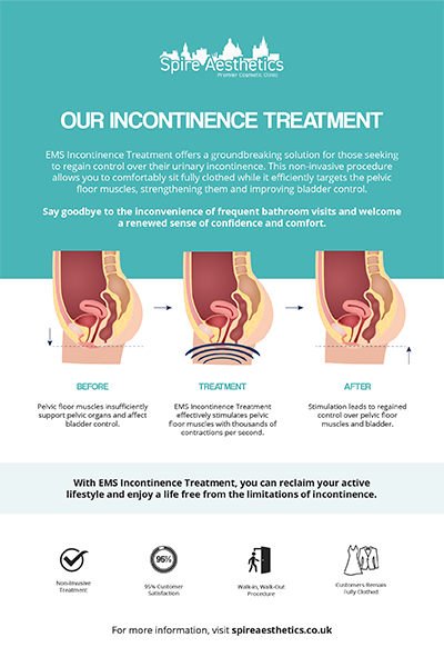 image of how urge incontinence Reading treatment works