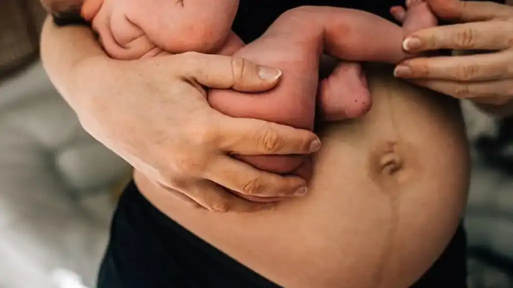 Why Is My Stomach Still Big After Pregnancy Reading?